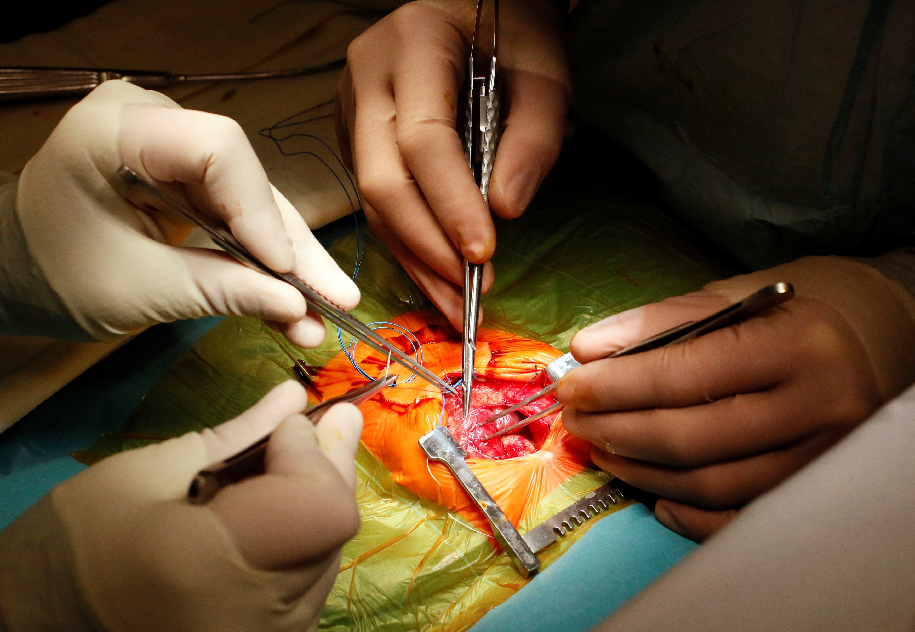 تراها كل يوم دون أن تلتفت إليها.. هذه العلامات تعني أن قلبك في خطر!