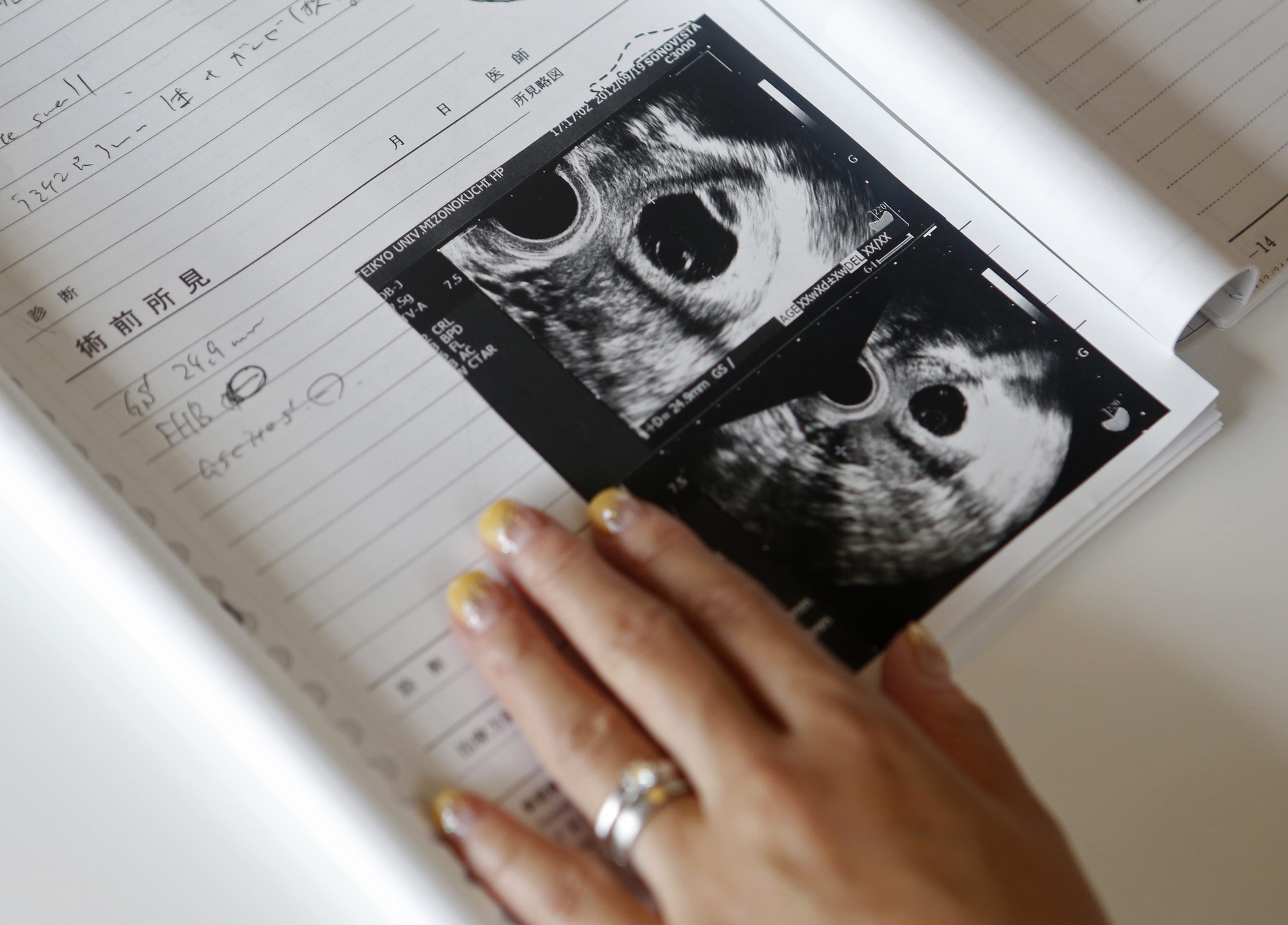 طباعة صورة الجنين على الأظافر وثقب أصابع اليد.. موضتان جديدتان، لكن الثانية خطيرة