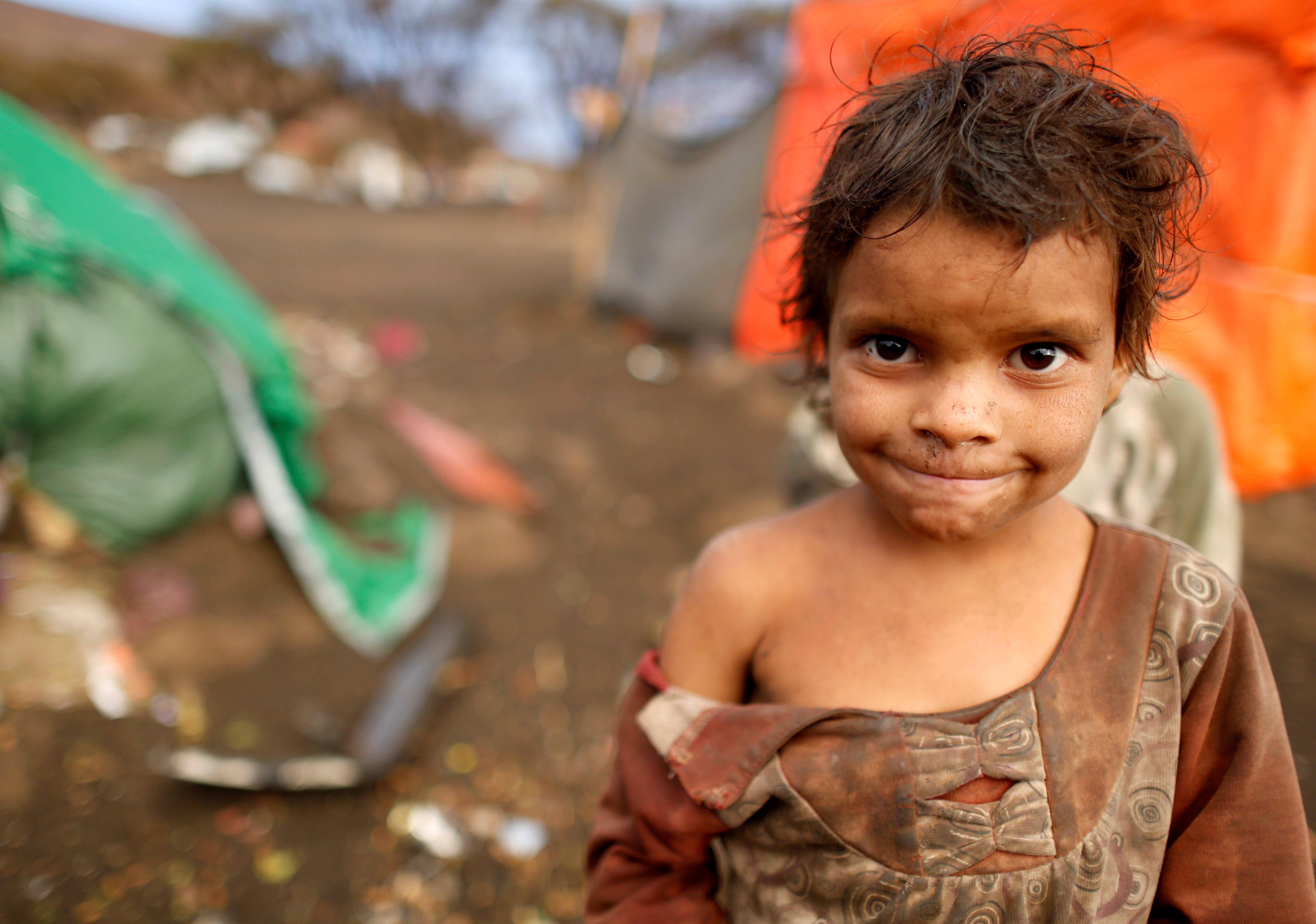 شاب يمني تلقى رصاصة ضالة فاكتشف الأطباء في جرحه خطراً صحياً قاتلاً.. البكتريا الخارقة تجتاح الشرق الأوسط