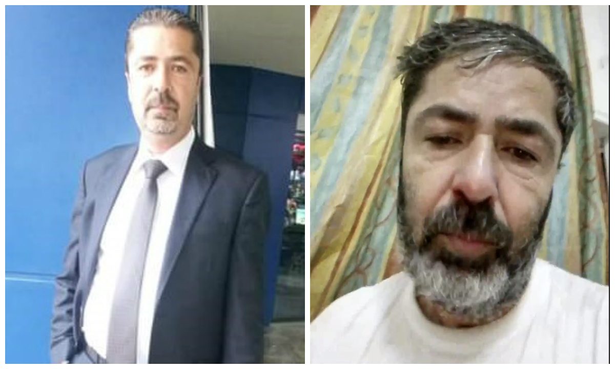 أردني يعرض نفسه للبيع: لم أتناول الطعام ليومين وعاجز عن علاج نفسي.. فمَن يشتري كليتي؟