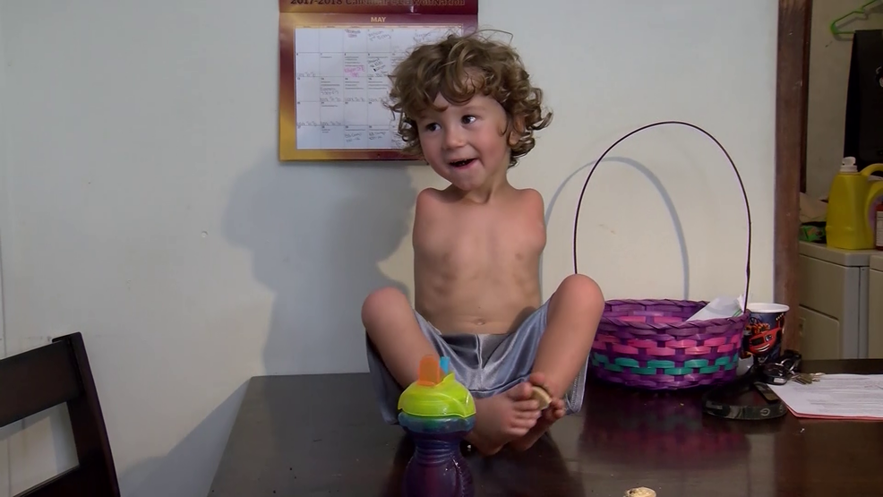 مطعم يمنع طفلاً صغيراً بلا أذرع من الأكل فيه لأنه يأكل باستخدام قدميه!