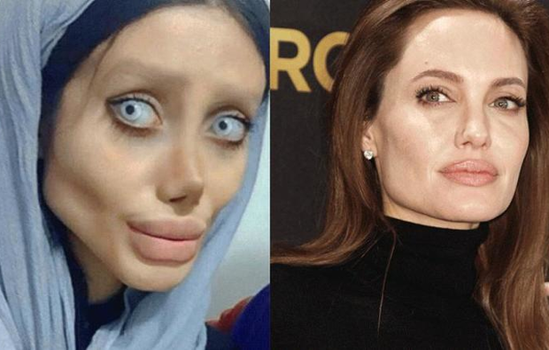 لا مزيد من الخداع.. هذا هو الوجه الحقيقي للشابة الإيرانية، شبيهة أنجلينا جولي(صور)