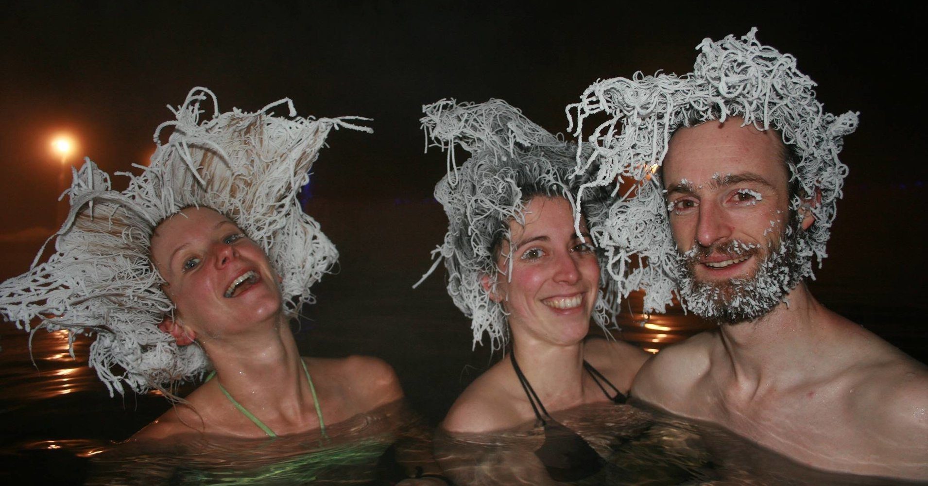 يجمدون شعورهم بطريقة مذهلة ويملكون دماً ذهبياً.. 10 قصص ستغير نظرتك للعالم