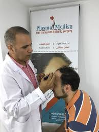رزاعة الشعر في تركيا