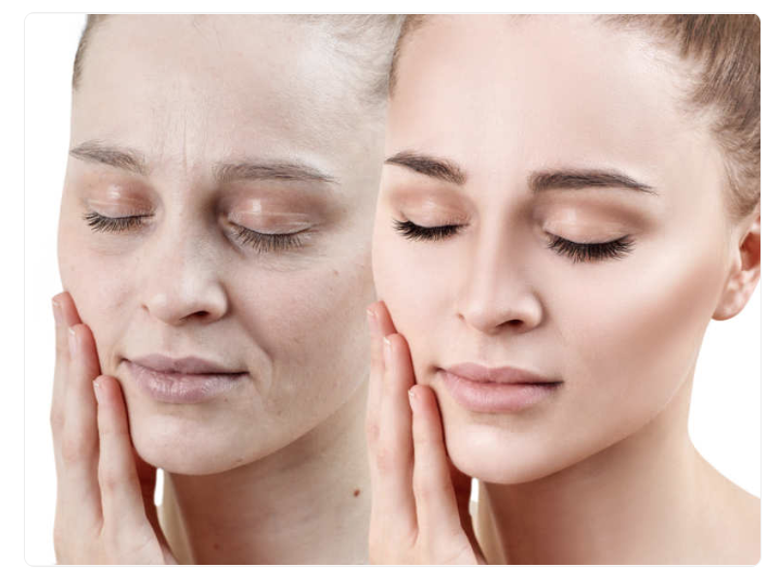 فوائد زيت الخردل للبشرة