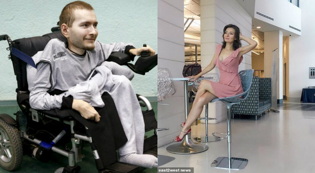 الحب يوقف أول عملية زرع رأس في العالم