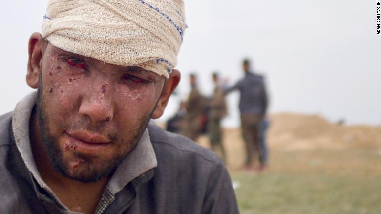أصيب عبد الرحمن في غارة جوية على منزله في باغوز