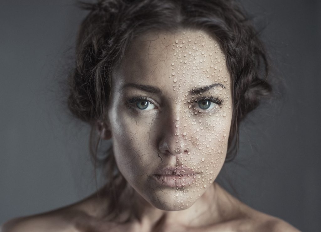 علاج البشرة الجافة