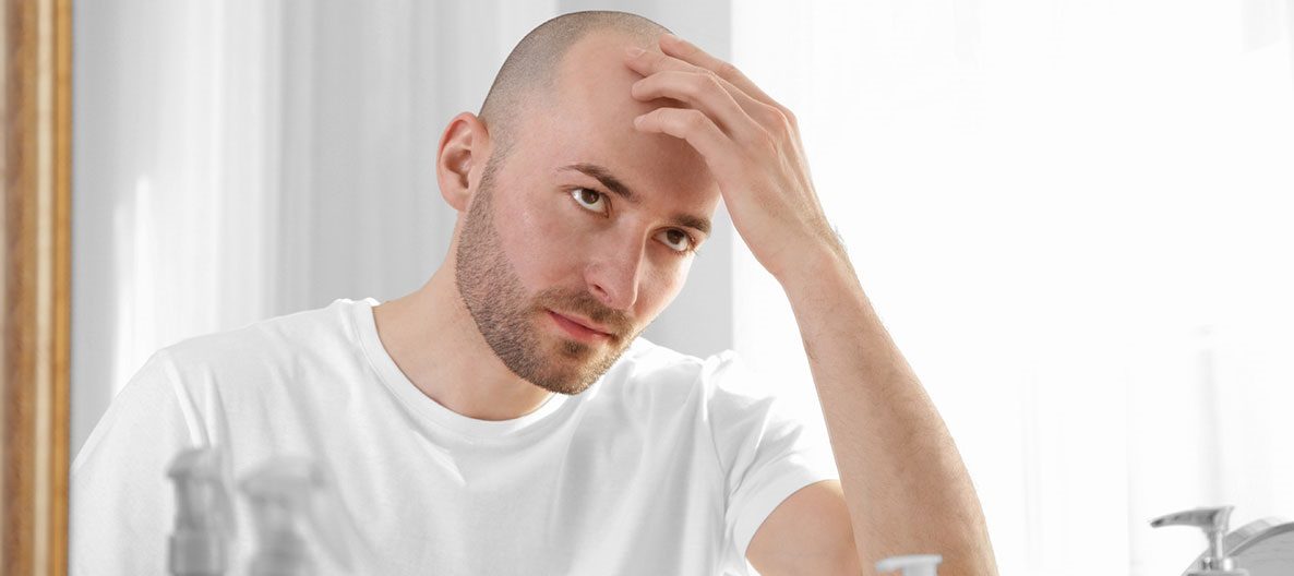 اكتشاف قد يضع حلاً لمشكلة الصلع