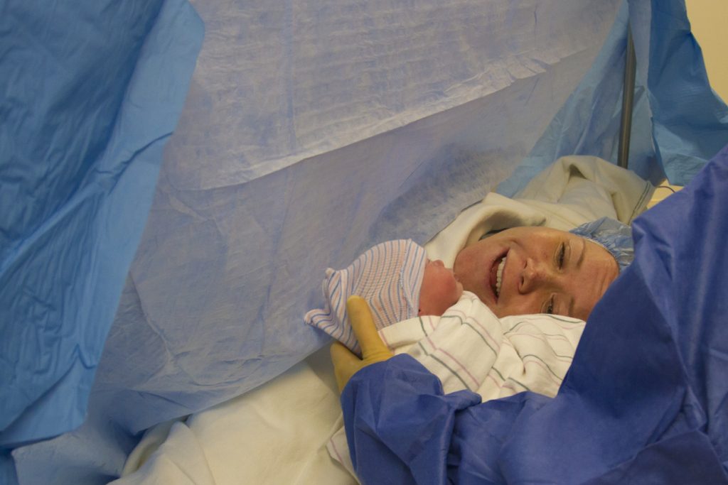 الولادة القيصرية