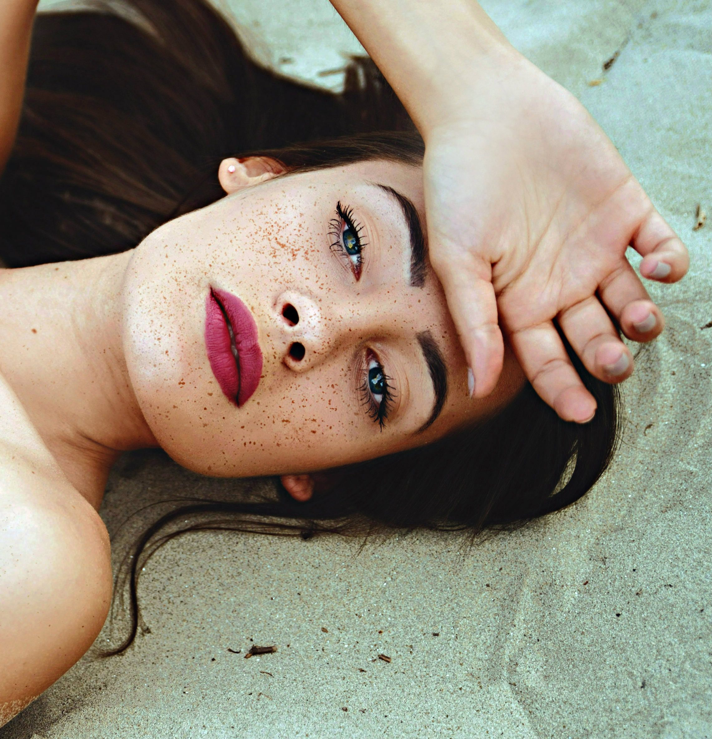 النمش.. أسبابه وعلاجه وقصة ارتباطه بالسحر في القرون الوسطى