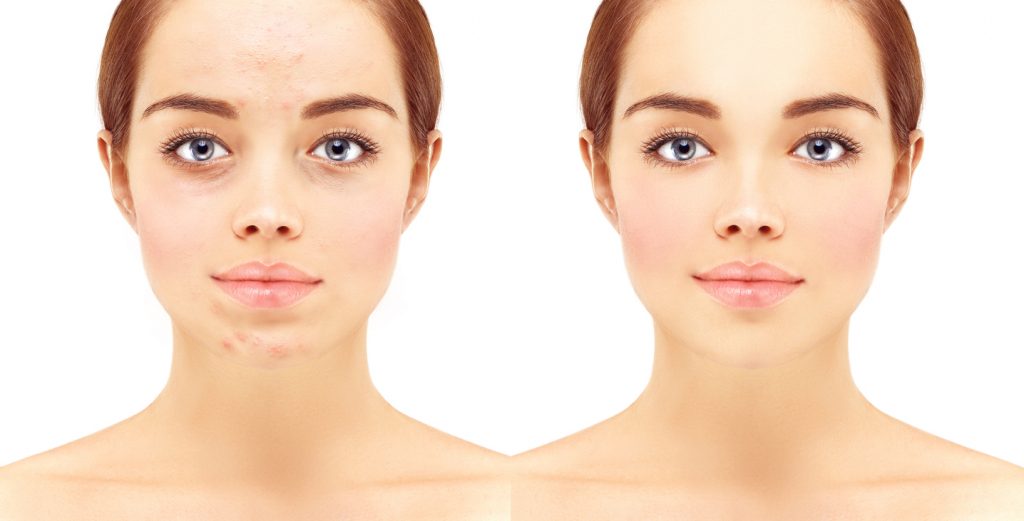 البشرة المختلطة