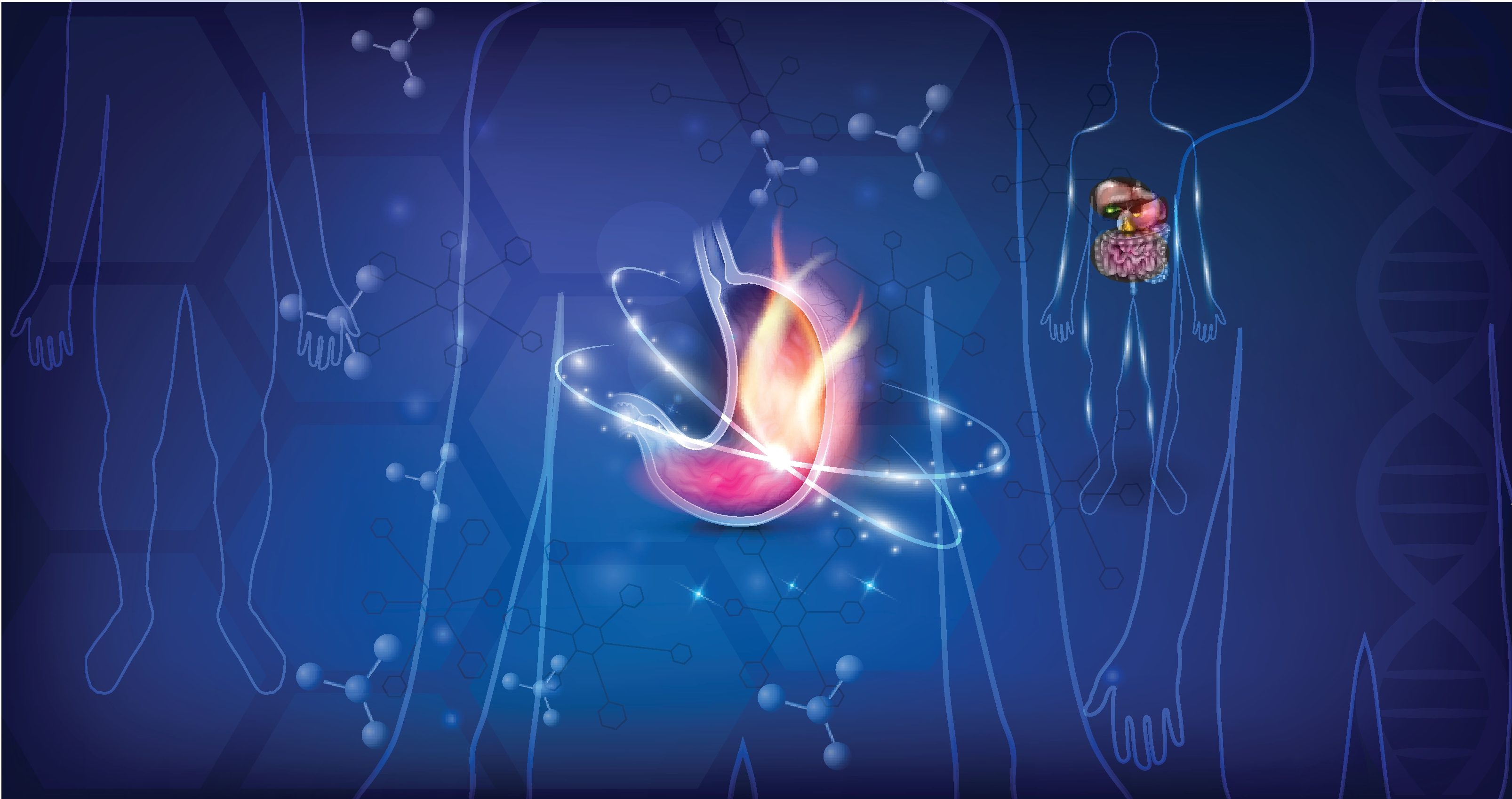 لها أعراض شائعة ومزعجة.. ما هي قرحة المعدة، وما أسبابها وطرق علاجها؟