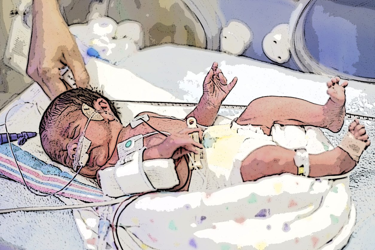 انفصال إجباري.. هنا المستشفى المقدسي الذي يموت فيه الرضع الفلسطينيون وحيدين دون آبائهم