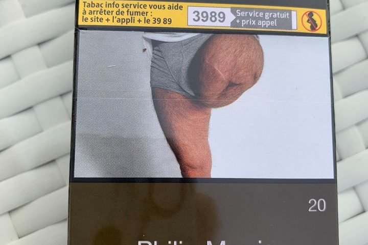 صورة ساق الرجل المبتورة