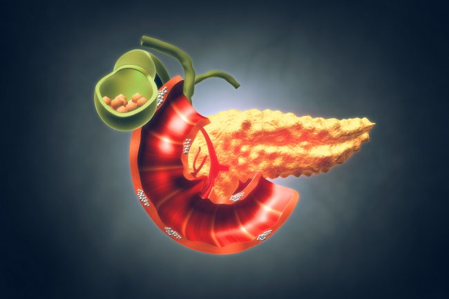 تعرَّف على أسباب التهاب البنكرياس وأعراضه