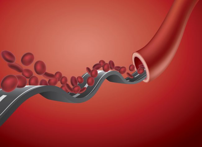 هذا كل ما تريد معرفته عن نقص الحديد في الدم وكيفية تعويضه