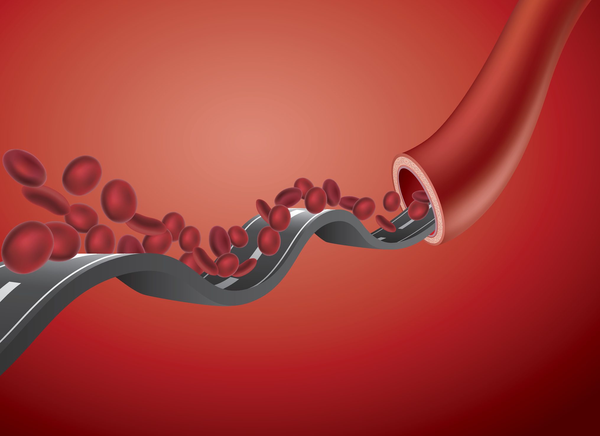 هذا كل ما تريد معرفته عن نقص الحديد في الدم وكيفية تعويضه