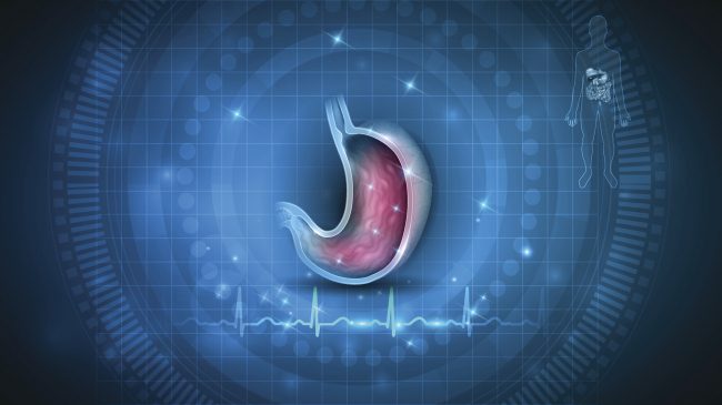 بعض أسبابه شائعة وقد تكون أكثر تعقيداً.. تعرَّف على أسباب ألم رأس المعدة وعلاجه