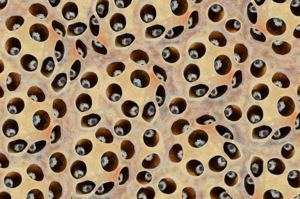 رهاب النخاريب