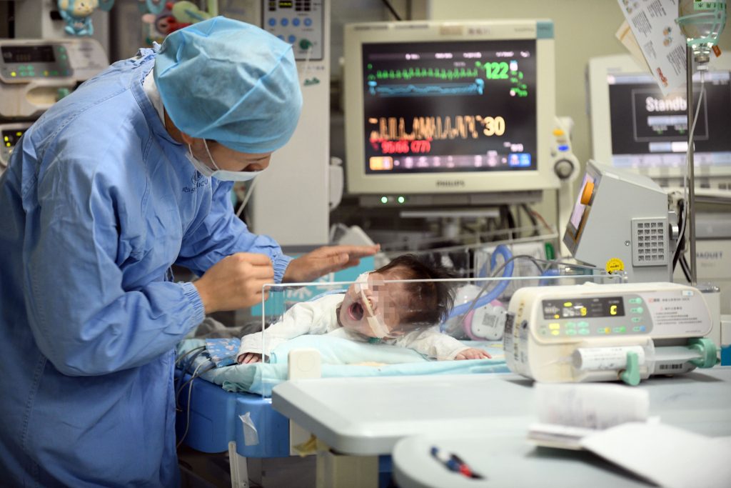 البرتغال ولادة طفل مشوه