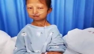 وزنها أصبح 21 كيلوغراماً.. غضب في الصين لأجل شابة تدعم أخاها المريض