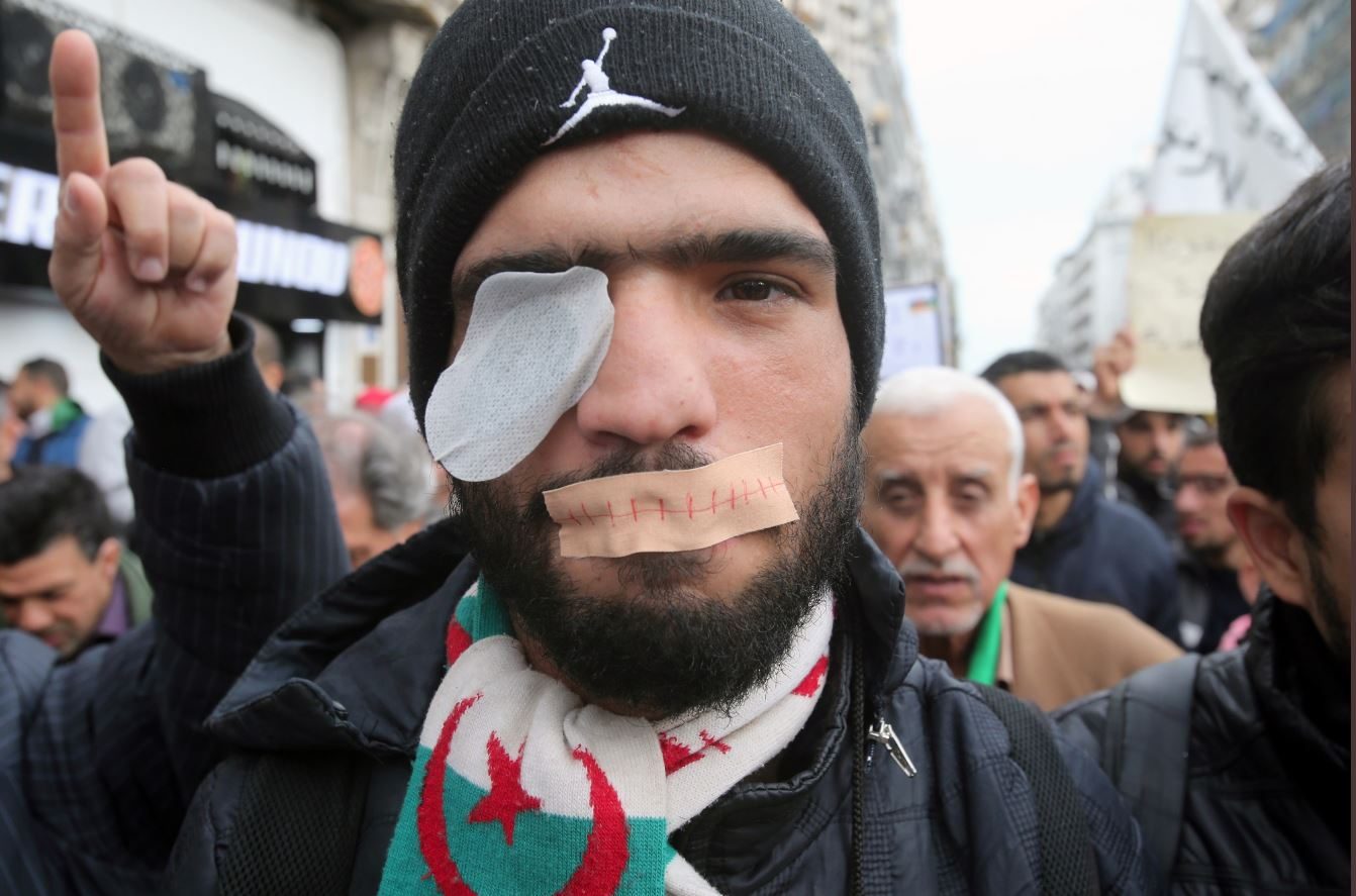 تضامن جزائري مع المتظاهرين الذين فقدوا أبصارهم بالرصاص المطاطي