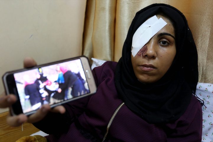الشابة الفلسطينية مي أبو رويضة / الأناضول
