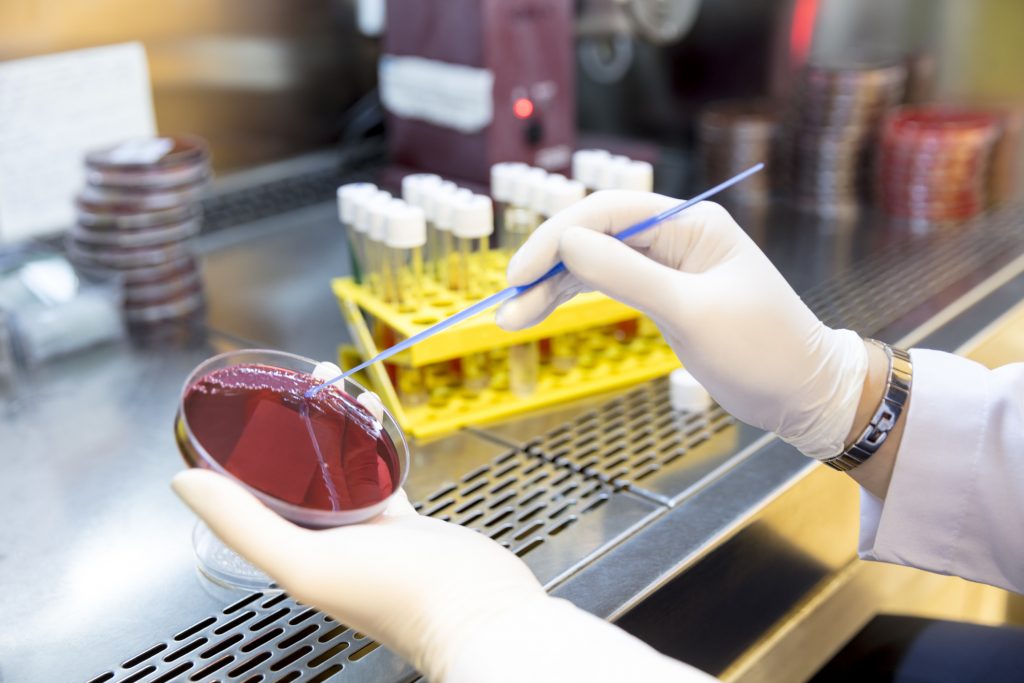 مضادات حيوية