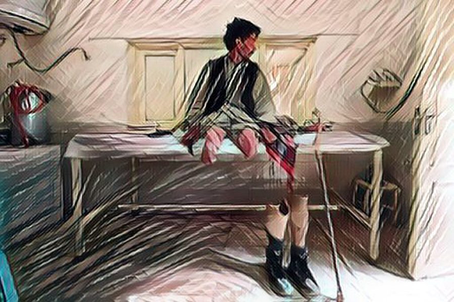 الحاجة تصنع المستحيل أحياناً.. كيف يتكيّف الأفغان الذين فقدوا أطرافهم بانفجار ألغام مع الحياة؟