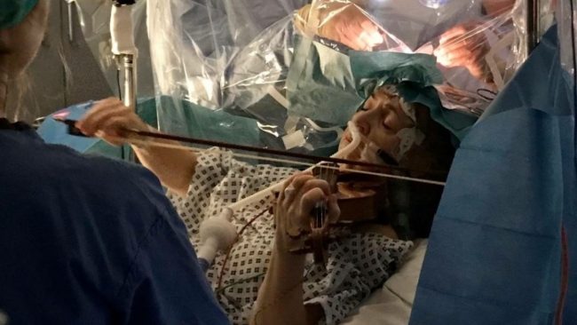 فيديو لسيدة تعزف الموسيقى وهي تُجري جراحة في مخها! الأطباء درسوا أدق تفاصيل الكمان لإنجاح العملية