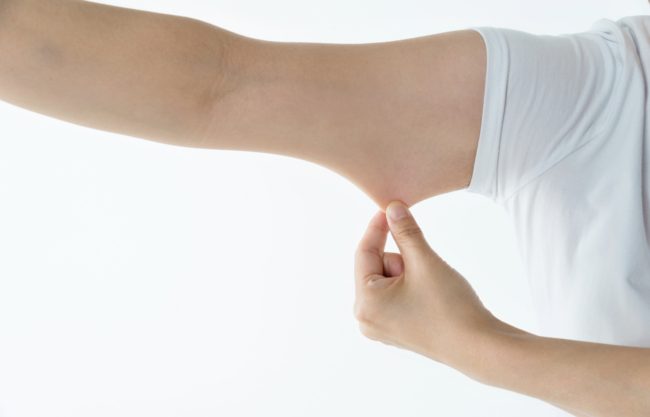 سبب ترهل الجلد بد فقدان الوزن، وطرق تفاديه وعلاجه