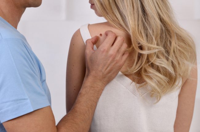 ما سبب ظهور الزوائد الجلدية، وهل إزالتها في المنزل آمنة؟