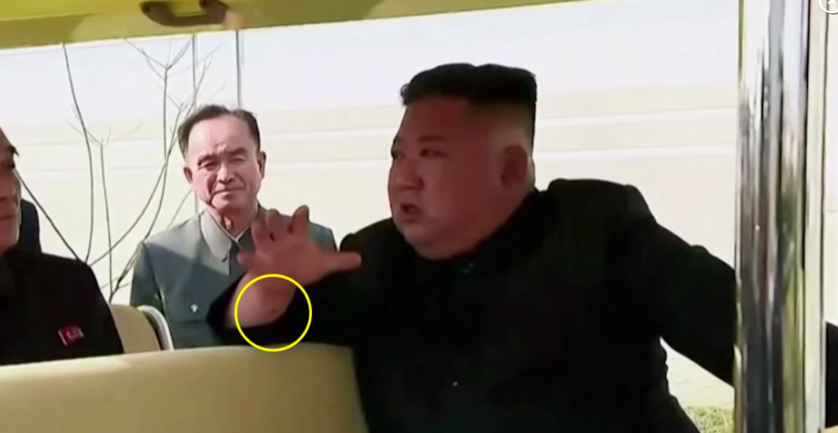 هل فضحت يد كيم سر غيابه الطويل؟ علامة ظهرت عليها لم تكن موجودة، وهذا ما تدل عليه