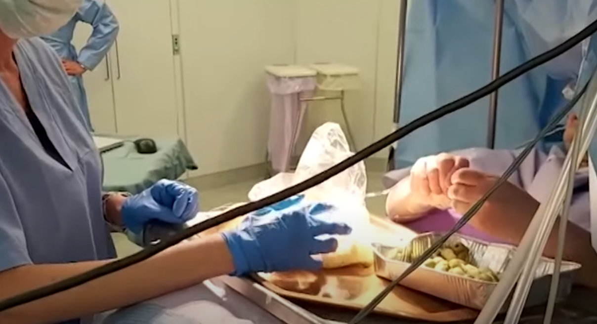 أعدت 90 حبة زيتون محشي ودماغها مفتوح! فيديو لسيدة تحضر وجبة إيطالية خلال عملية حساسة