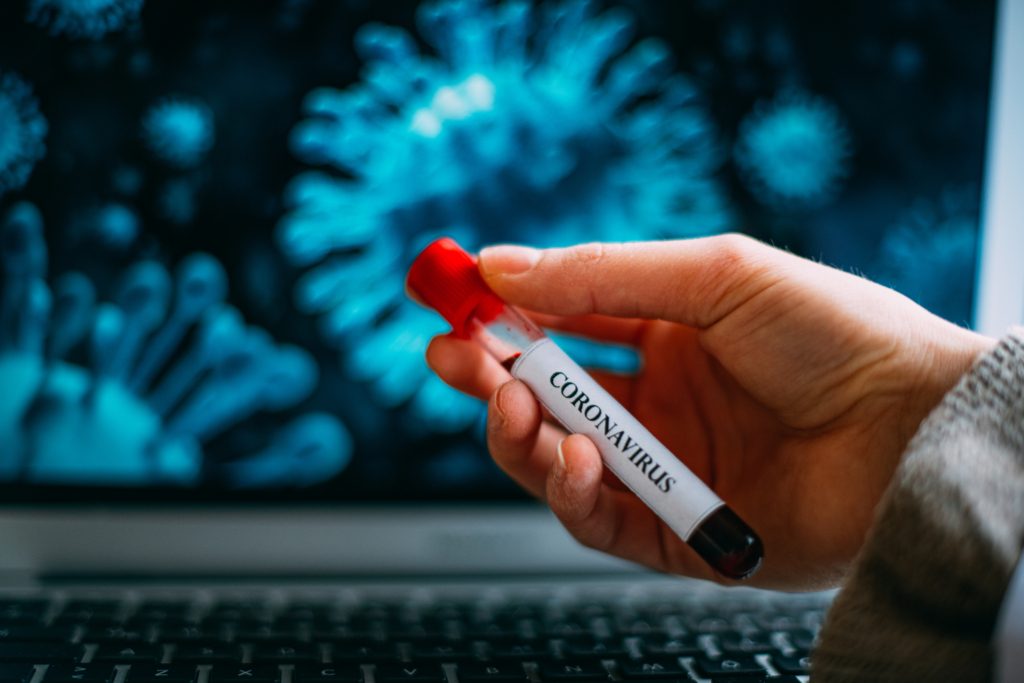 لقاح فيروس كورونا