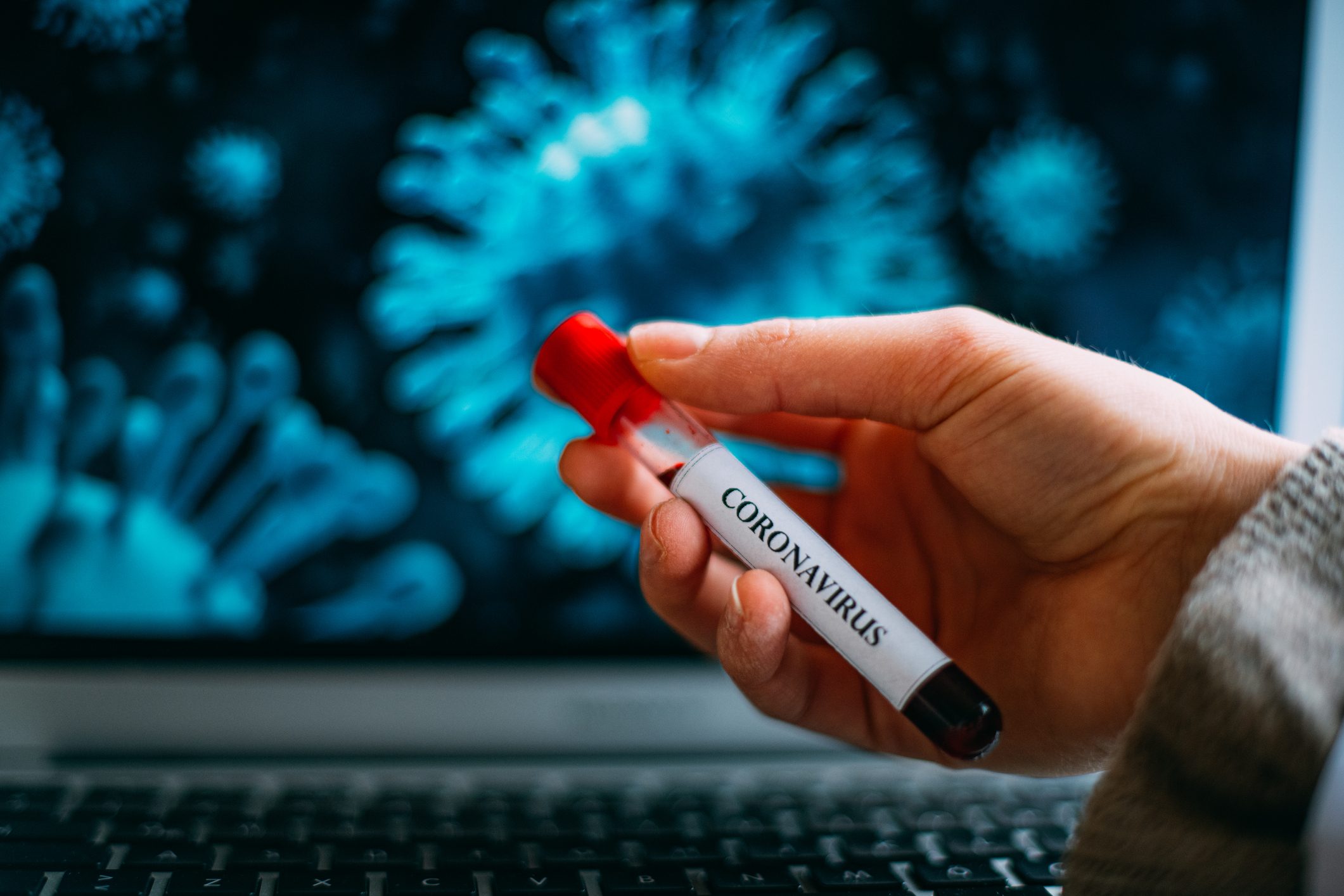 لقاح فيروس كورونا