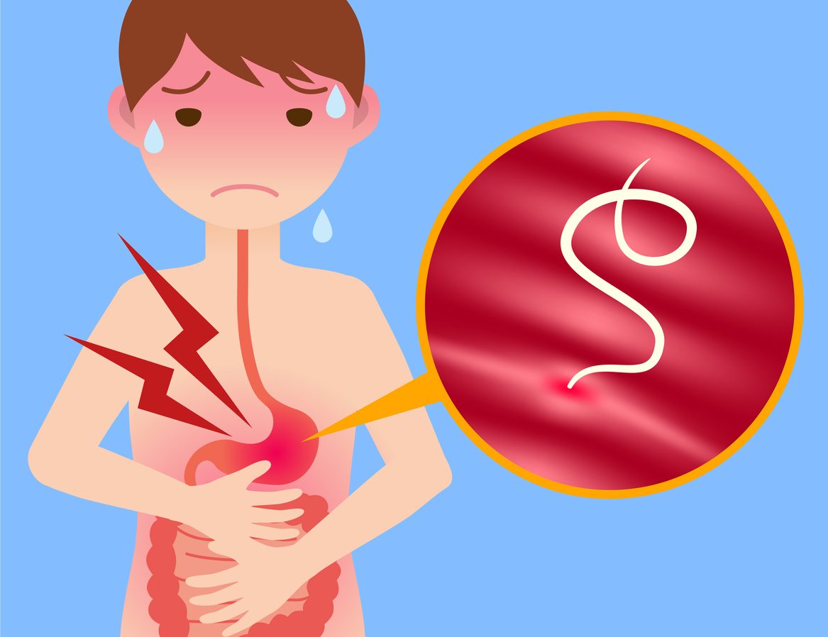 ديدان البطن البيضاء