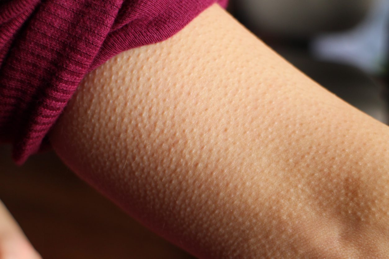 ربما يكون العلم قد توصل أخيراً إلى تفسير لماذا نصاب بالقشعريرة؟