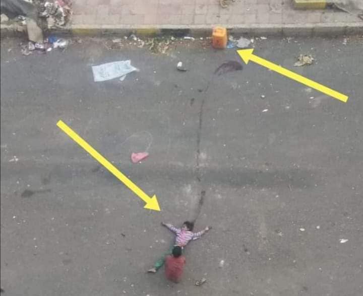 خرجت تبحث عن المياه فاستهدفها قناص حوثي.. “طفلة يمنية” تنجو من موت محقق بعد إنقاذ بطولي من شقيقها