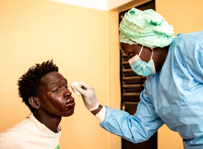 مرضٌ جلديٌّ غامض يصيب مِئات الصيادين بالسنغال.. السلطات فرضت “حجراً صحياً” (صور)