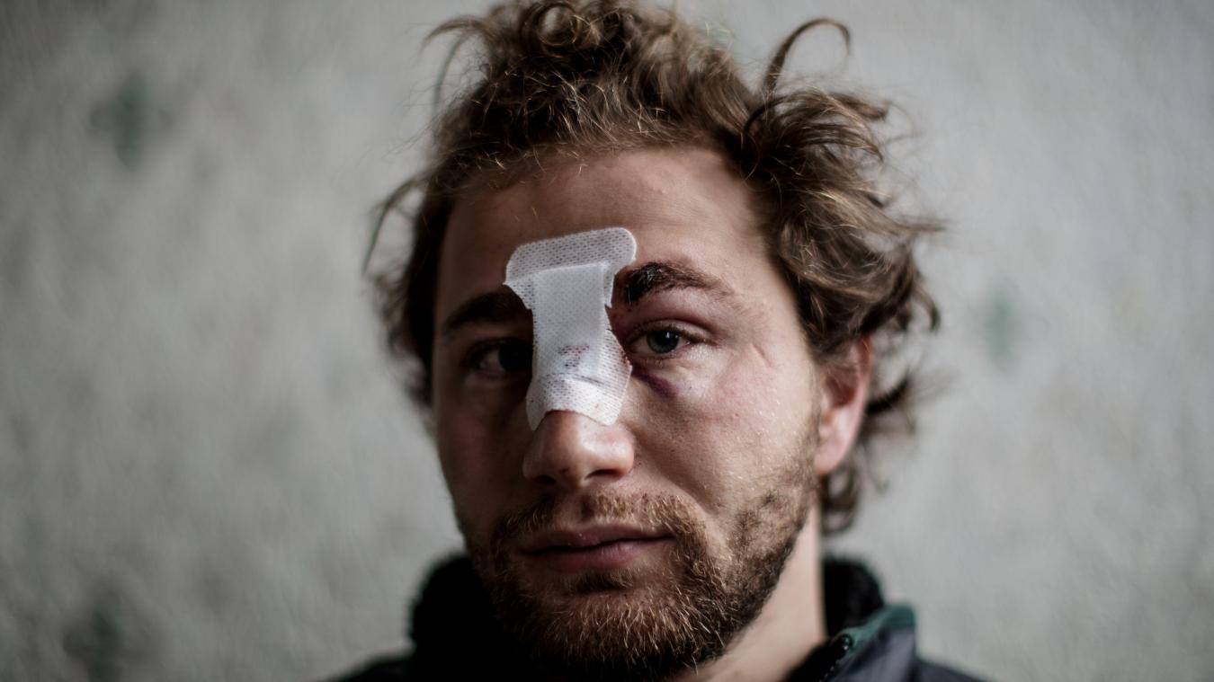 هرب من حرب سوريا ليقع ضحية شرطة فرنسا.. مصور سوري يروي تفاصيل الاعتداء عليه بباريس