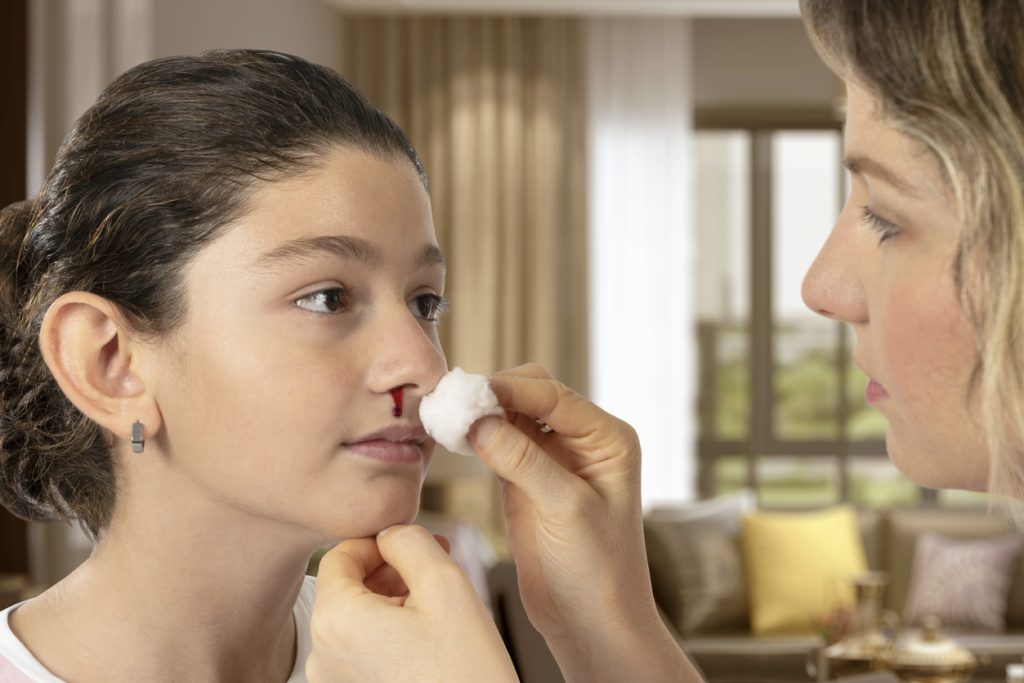 نزيف الأنف عند الأطفال