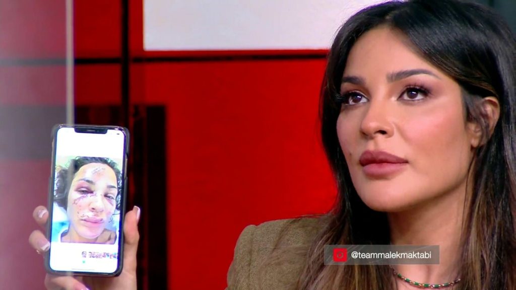 نادين نجيم انفصال