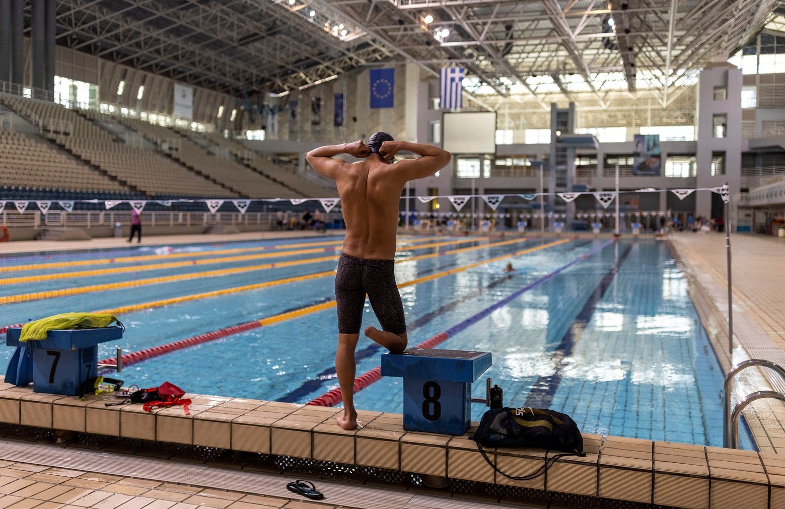 لاجئ سوري فقد ساقه