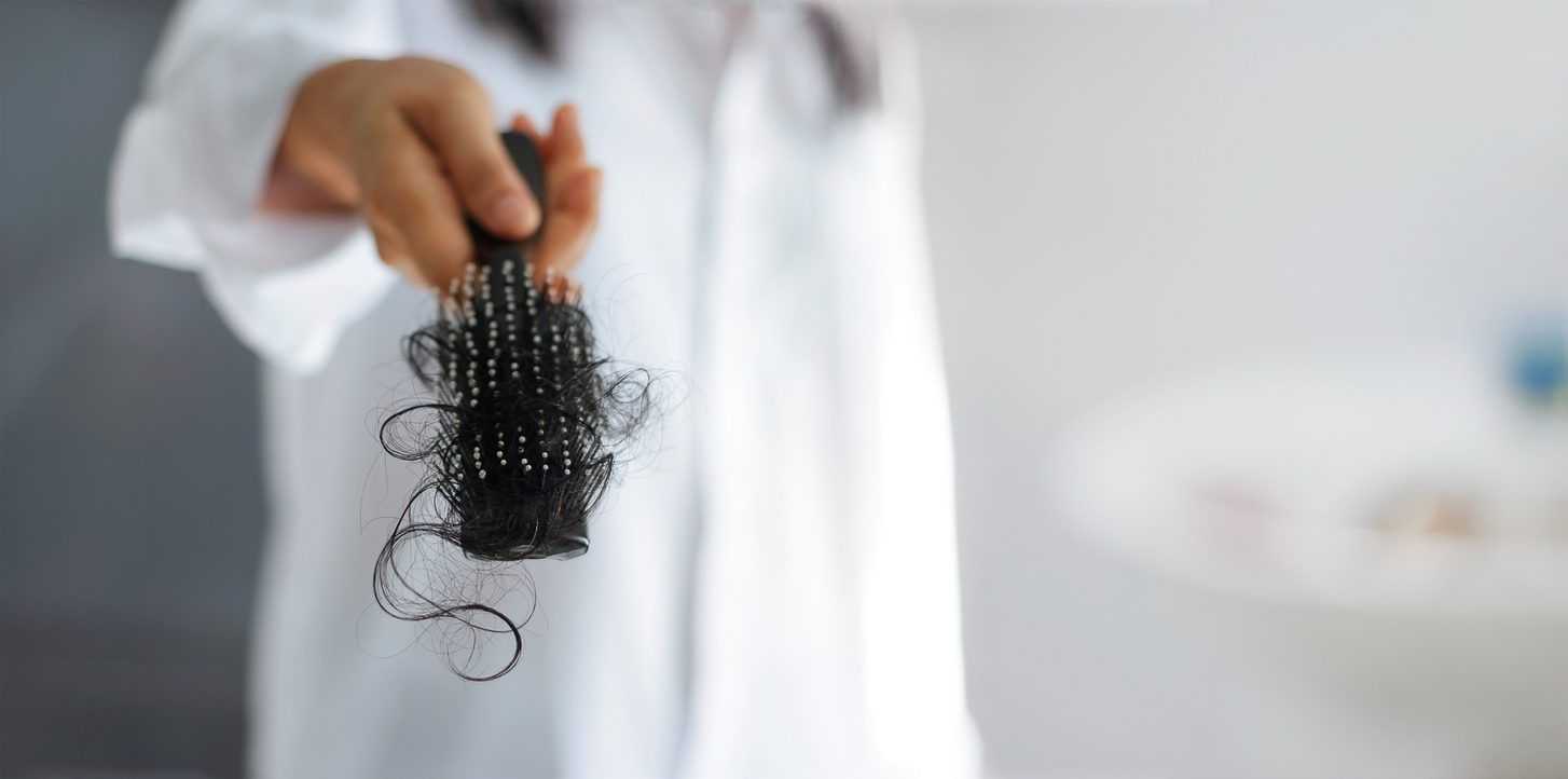 تساقط الشعر