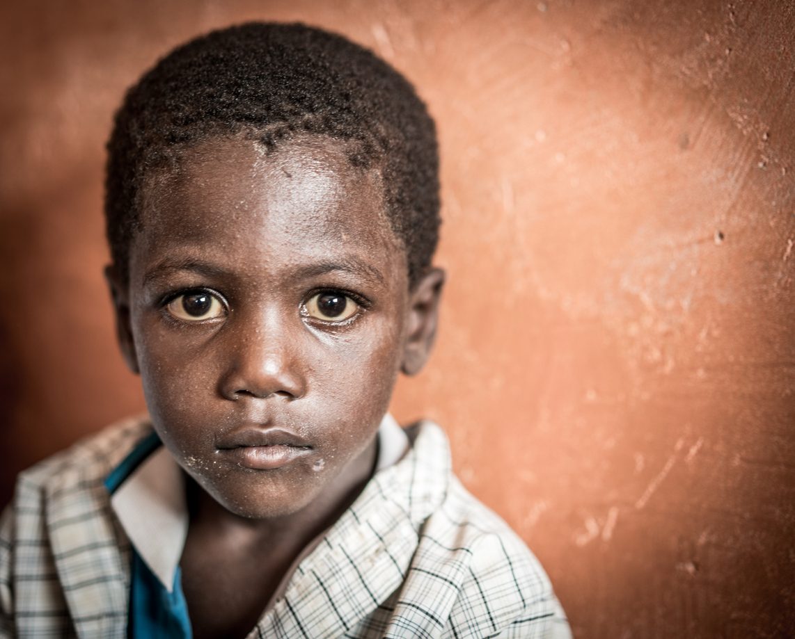 لماذا لم يجرَّب اللقاح أولاً على الأفارقة؟! عن شرور الإنسانية في أبهى صورة لها