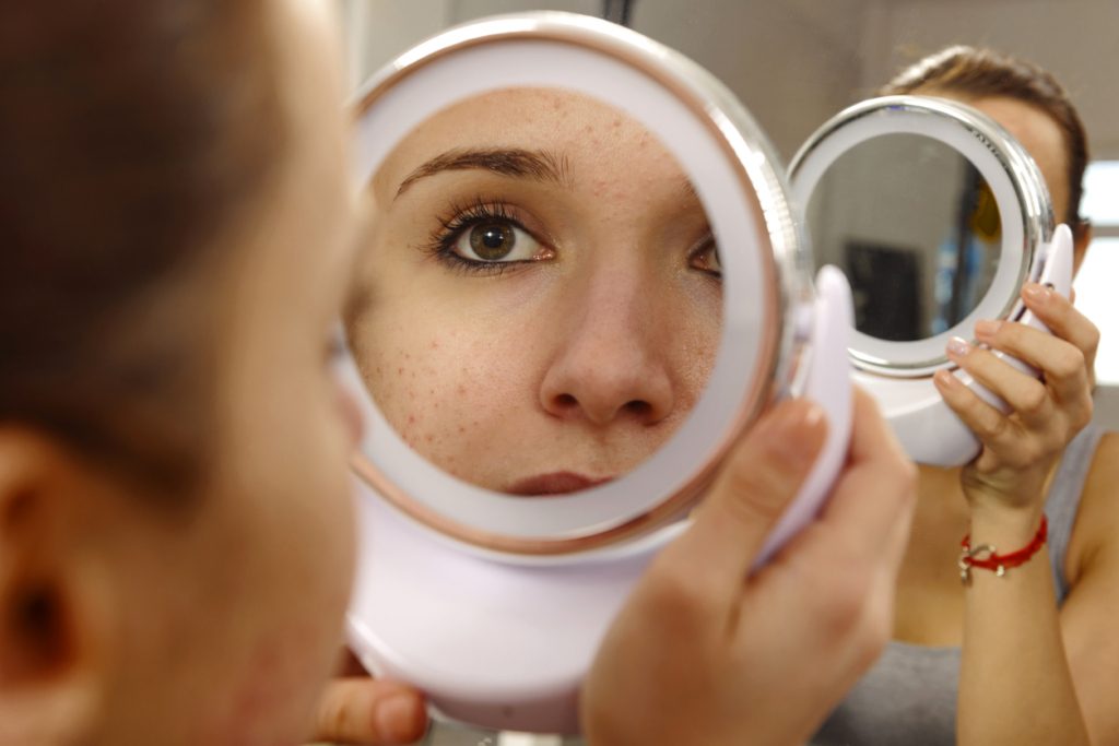 أسباب البقع الجلدية مختلفة اللون