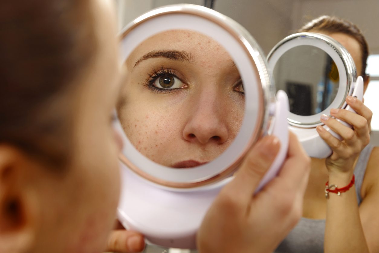 أسباب البقع الجلدية مختلفة اللون