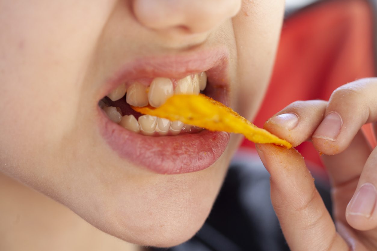 الأسنان الصفراء \ iStock